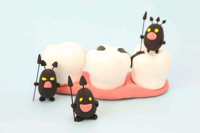 虫歯になる３つの原因　原因菌と口内環境を整える菌、糖質、歯の質